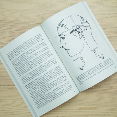 Zmodyfikowana akupunktura czaszki doktora Yamamoto (YNSA)