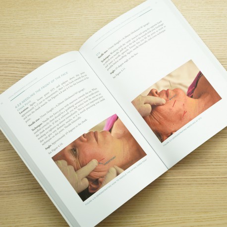 Facial Enhancement Acupuncture. Clinical Use and Application